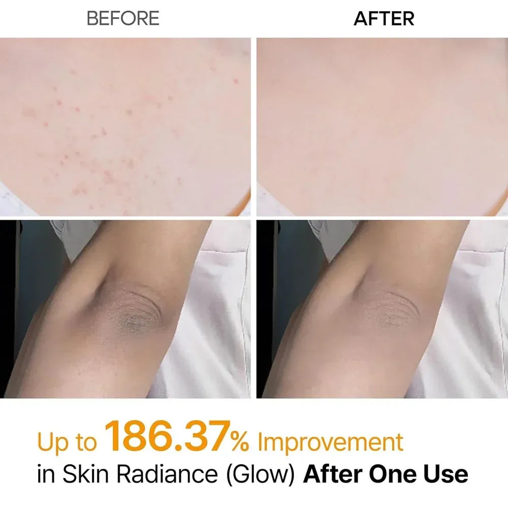 Dr. Melaxin Kojic Acid & Turmeric Body Peeling Spray – Exfoliating & Glow Care