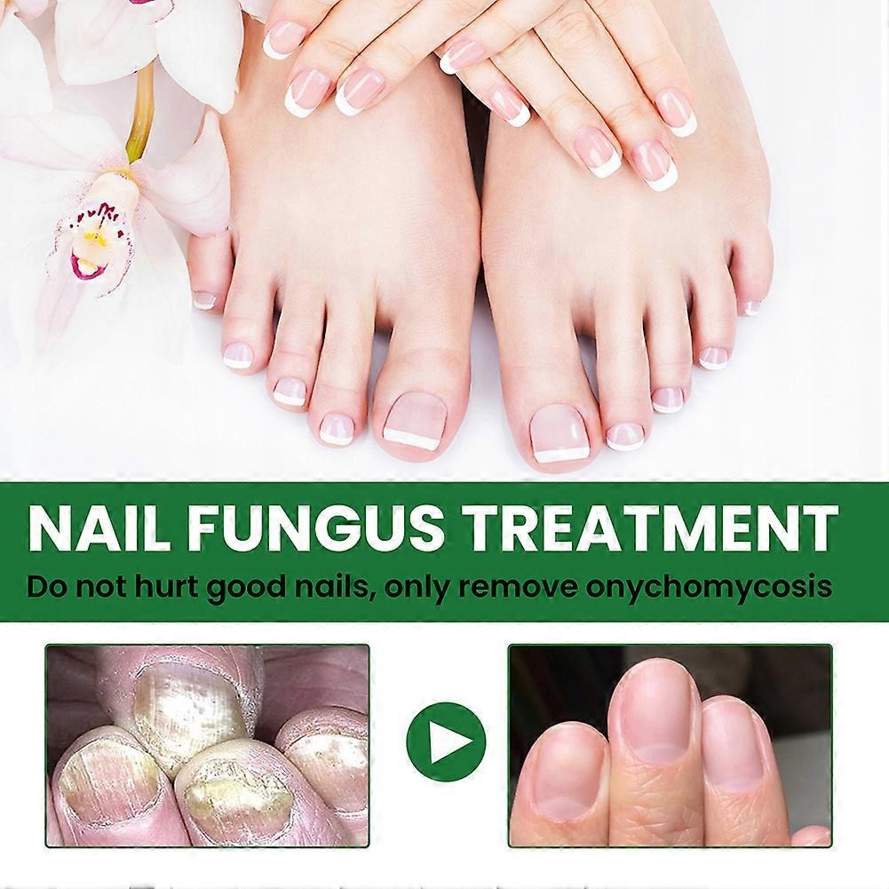 Nail Serum for Repair & Growth
