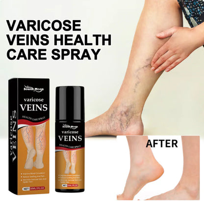Varicose Vein Relief Spray