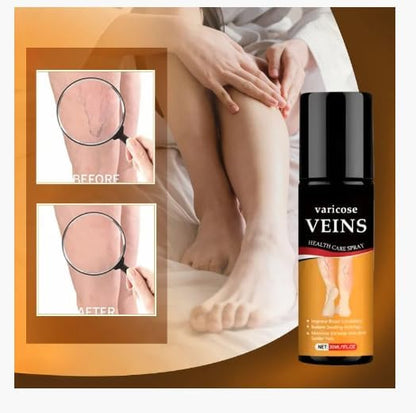 Varicose Vein Relief Spray