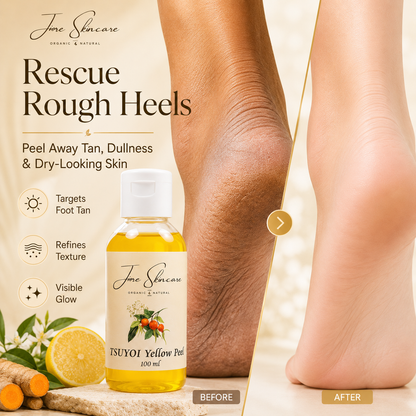 Yellow Skin Brightening Peel - 30 Sec Formula