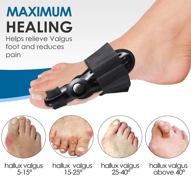 Toe Thumb Aligner + Pain Relief