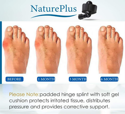 Toe Thumb Aligner + Pain Relief