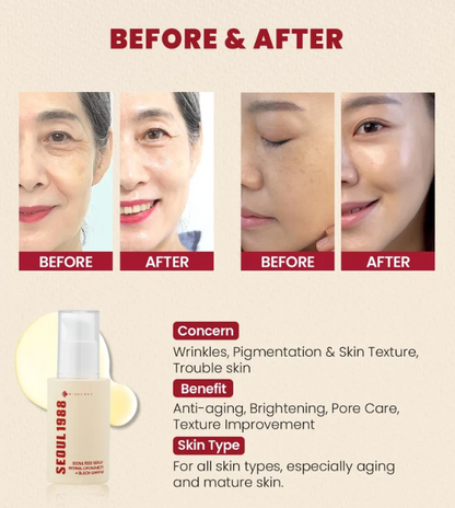 Seoul 1988 - Japanese Lip Whitening Serum