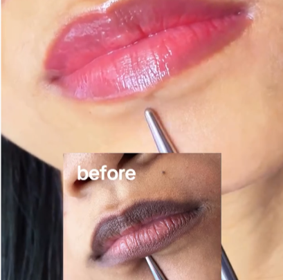 Seoul 1988 - Japanese Lip Whitening Serum