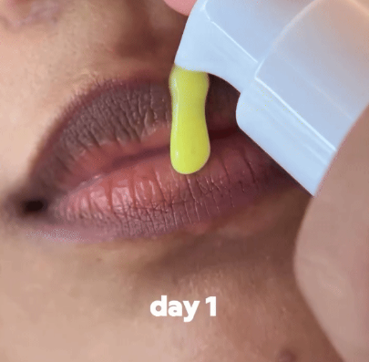 Seoul 1988 - Japanese Lip Whitening Serum