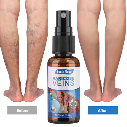 Varicose Vein Relief Spray