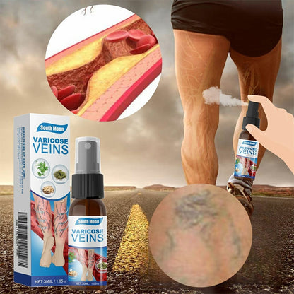 Varicose Vein Relief Spray