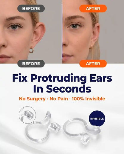 Set Aurix®  Ear Corrector Clip