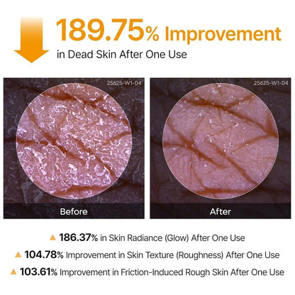 Dr. Melaxin Kojic Acid & Turmeric Body Peeling Spray – Exfoliating & Glow Care