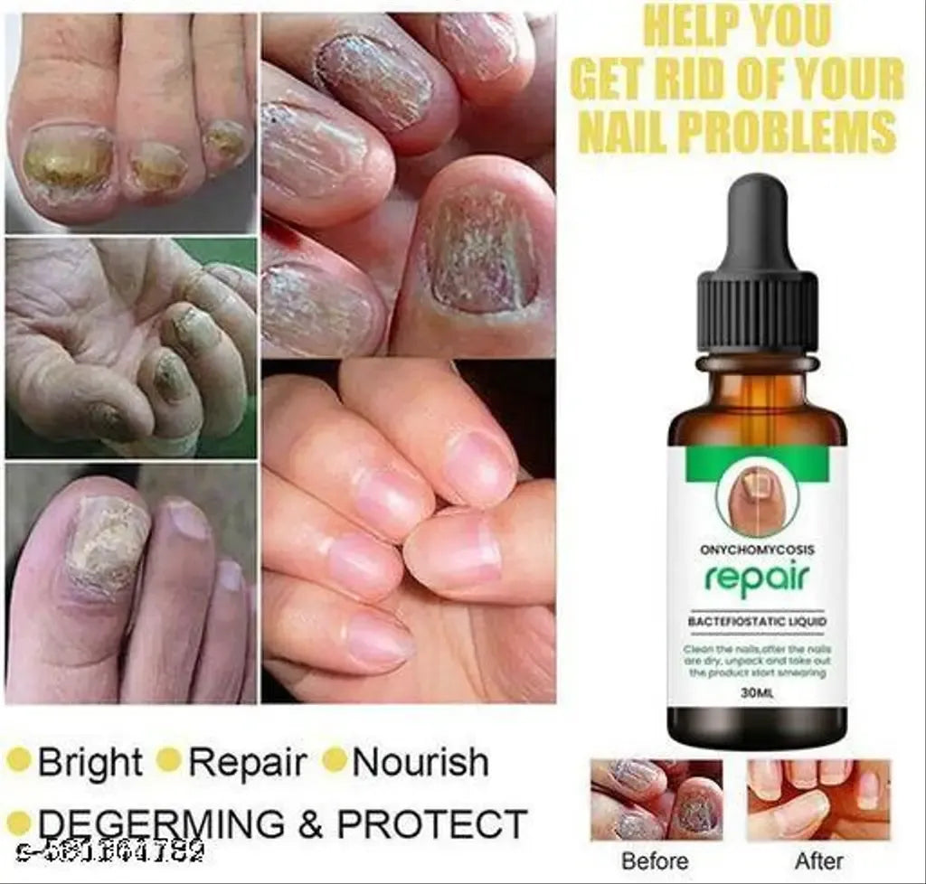 Nail Serum for Repair & Growth