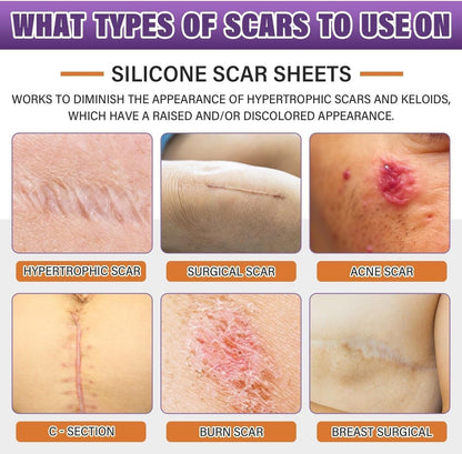 Universal Use Silicone Scar Sheets