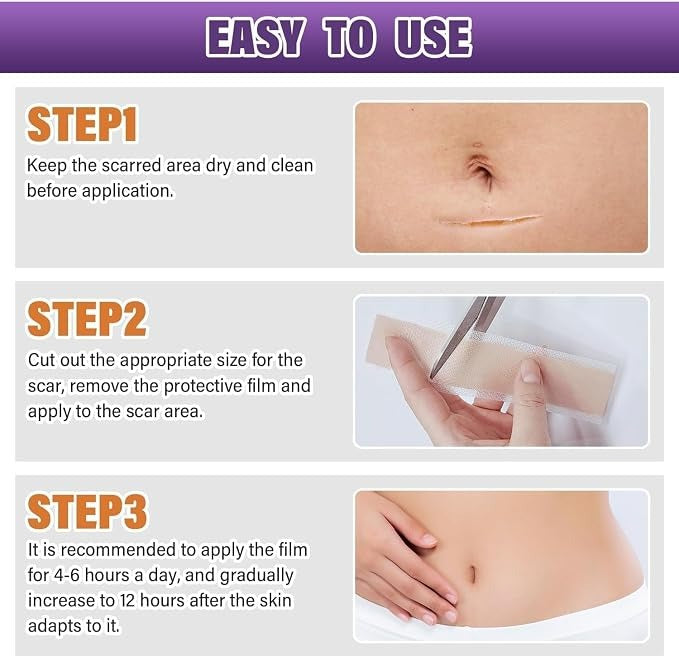 Universal Use Silicone Scar Sheets