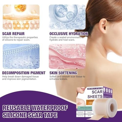 Universal Use Silicone Scar Sheets