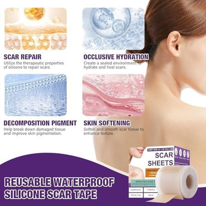 Universal Use Silicone Scar Sheets