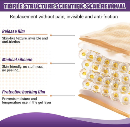 Universal Use Silicone Scar Sheets