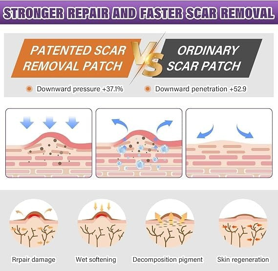 Universal Use Silicone Scar Sheets