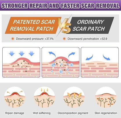 Universal Use Silicone Scar Sheets