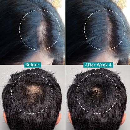 Advanced Hair Growth Pilgrim Oil