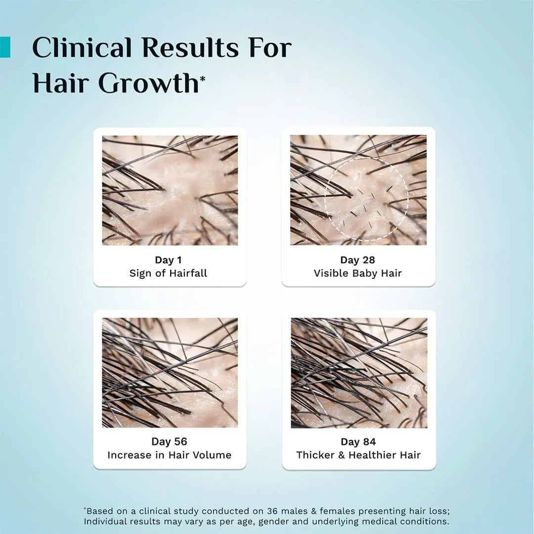Advanced Hair Growth Pilgrim Oil