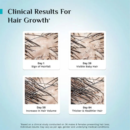 Advanced Hair Growth Pilgrim Oil