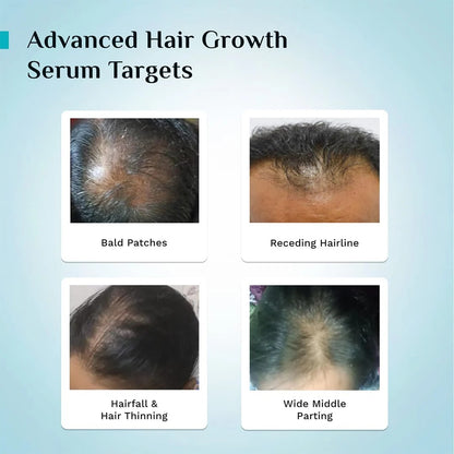 Advanced Hair Growth Pilgrim Oil